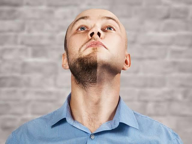 BEARD TRANSPLANT